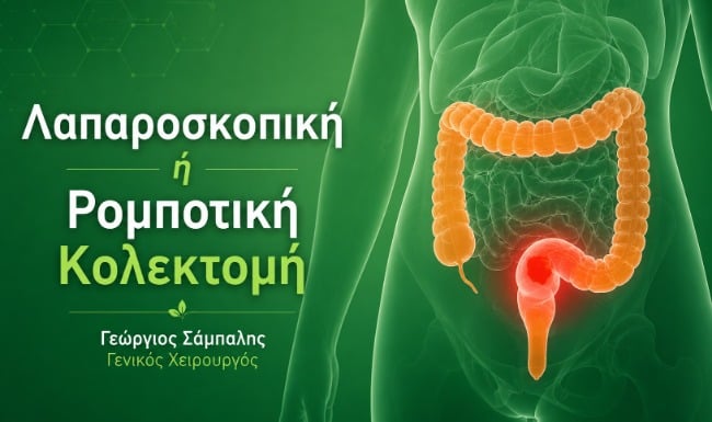 Κόστος κολεκτομής