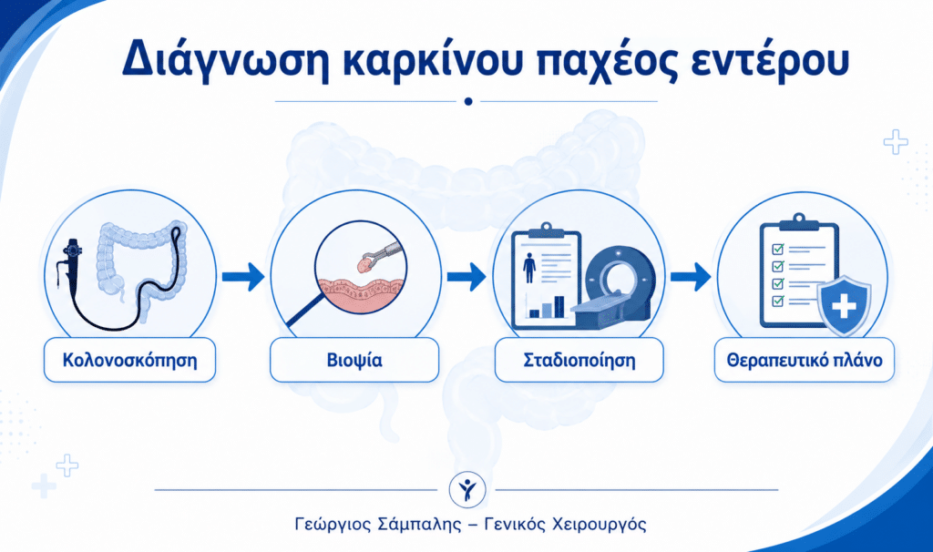 Διαγνωστική πορεία για καρκίνο παχέος εντέρου με κολονοσκόπηση, βιοψία και σταδιοποίηση