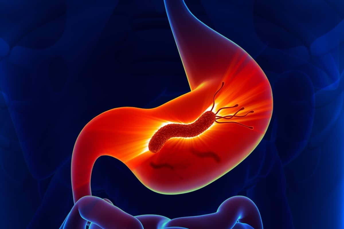 Helicobacter pylori