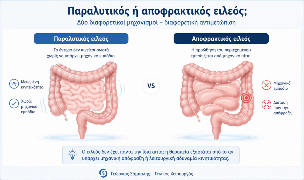 Διαφορά παραλυτικού και αποφρακτικού ειλεού στο έντερο