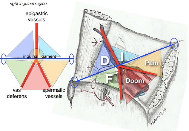 “triangle of doom” και “triangle of pain”