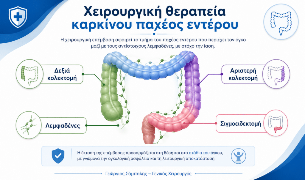 Χειρουργική θεραπεία καρκίνου παχέος εντέρου με δεξιά κολεκτομή, αριστερή κολεκτομή και σιγμοειδεκτομή