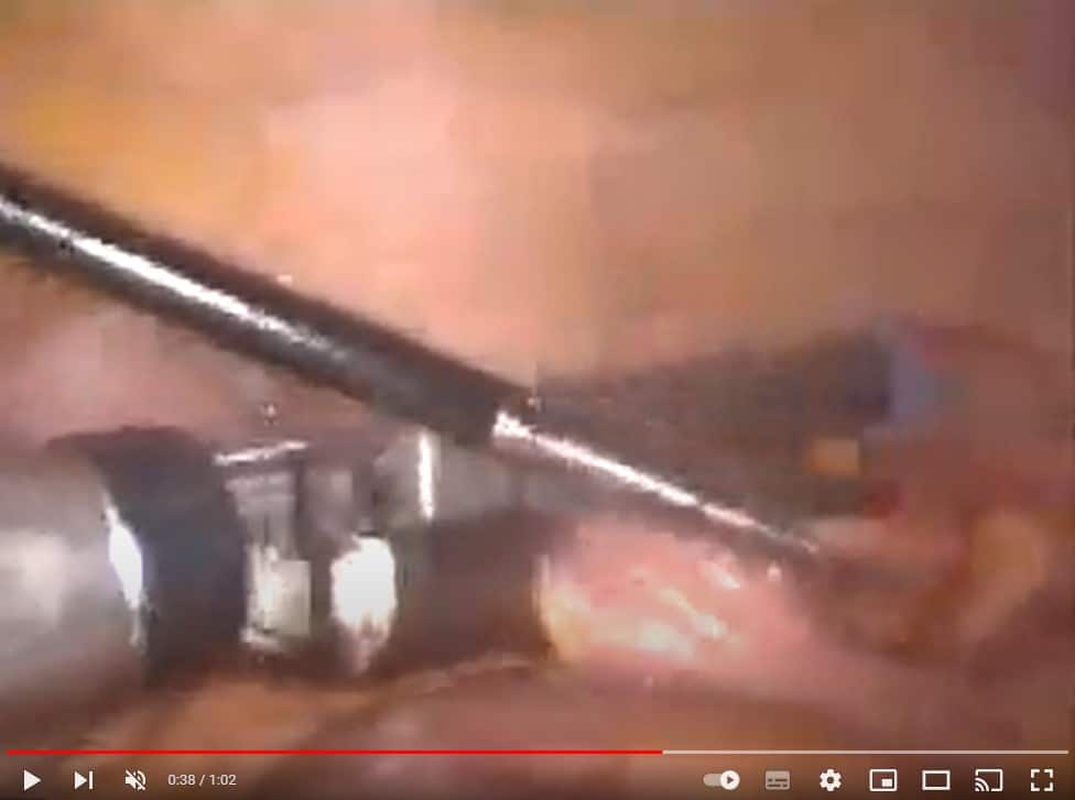 Video_lap_right_colectomy - Γεώργιος Σάμπαλης Λαπαροσκοπική Δεξιά Κολεκτομή