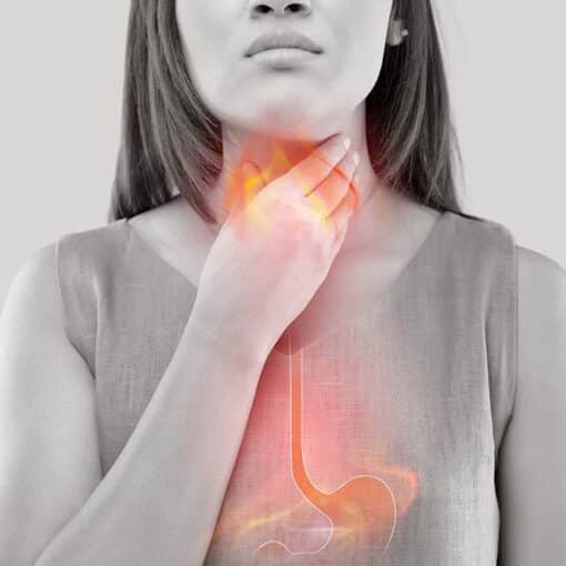 Λαπαροσκοπική Θολοπλαστική – Nissen