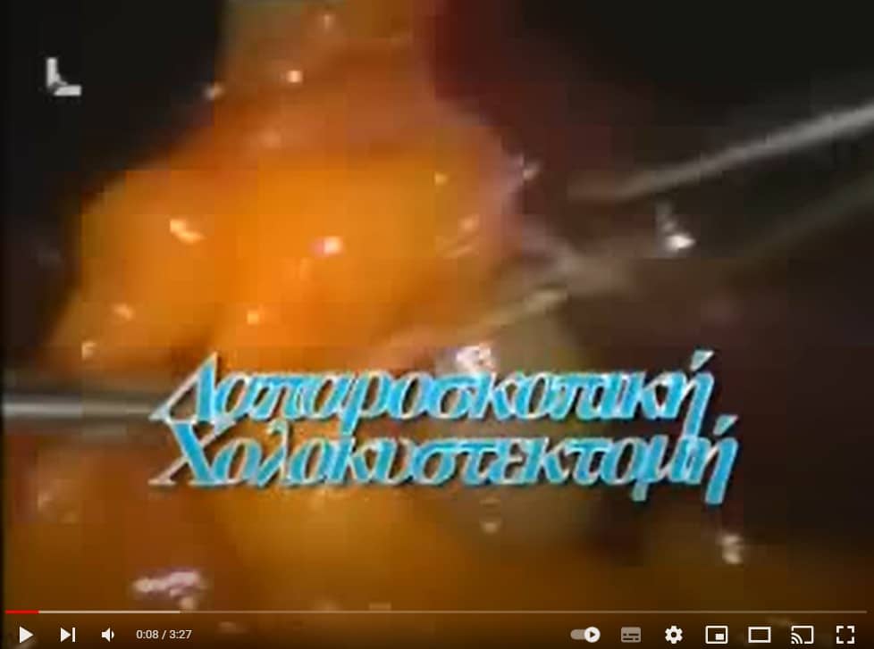Λαπαροσκοπική Χολοκυστεκτομή
