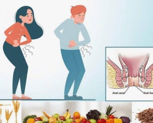 Διατροφή για την ραγάδα πρωκτού: Τι πρέπει να τρώτε και τι να αποφεύγετε.
