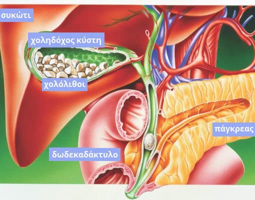 Πέτρα στην χολή – Φάρμακα για διάλυση.