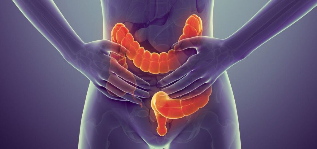 Πρώιμα Συμπτώματα του Καρκίνου του Παχέος Εντέρου και η Σχέση με την Ανατομία του