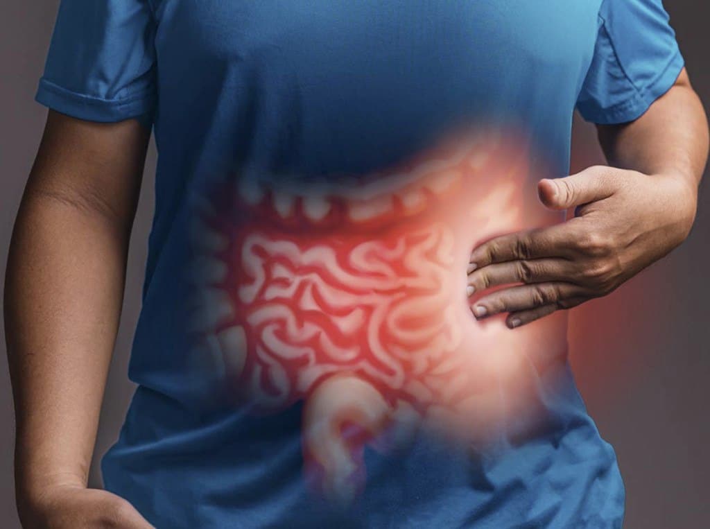 Νόσος Crohn - Ενδείξεις Χειρουργικής Αντιμετώπισης