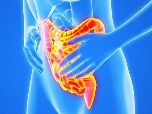 Ελκώδης Κολίτιδα - Ενδείξεις Χειρουργικής Αντιμετώπισης