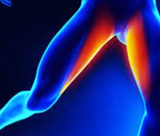 Χειρουργική Αντιμετώπιση Κήλης Αθλητών: Ενδείξεις