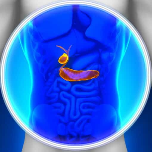 Χολολιθίαση Πέτρες στην χολή