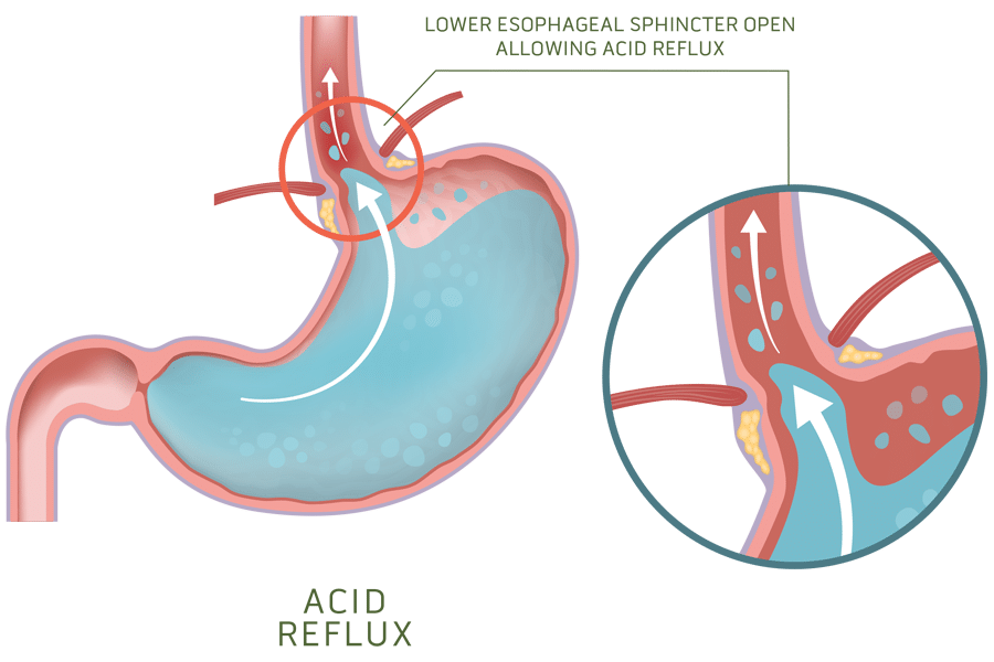 Παλινδρόμηση