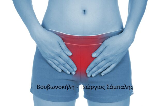 Βουβωνοκήλη – Χειρουργός Γεώργιος Σάμπαλης