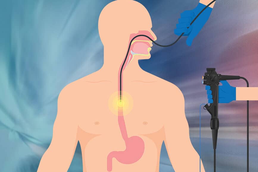 Μανομετρία οισοφάγου