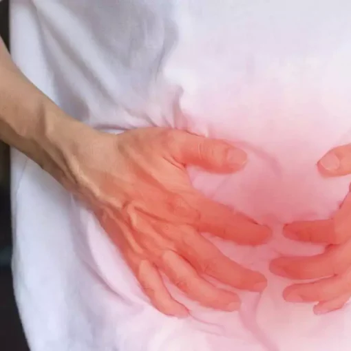 Αμφοτερόπλευρη Βουβωνοκήλη