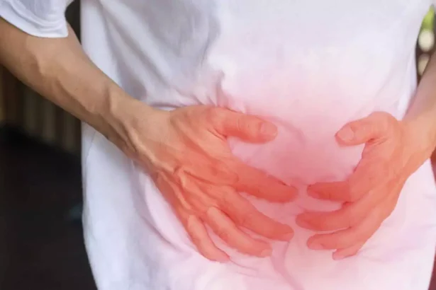 Αμφοτερόπλευρη Βουβωνοκήλη