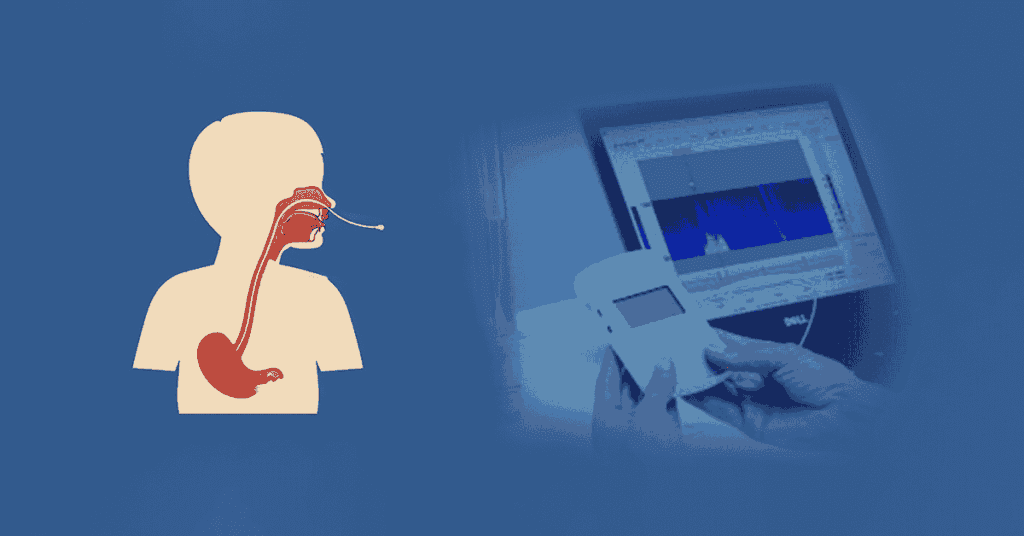 24hour (pH-impedance)