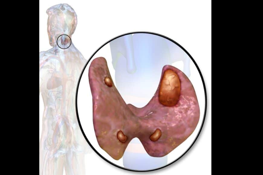 Παραθυρεοειδείς