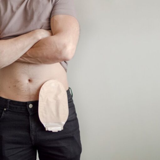 Κολοστομιες