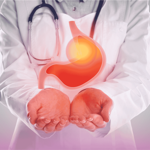 Αχαλασία και ΓΟΠ