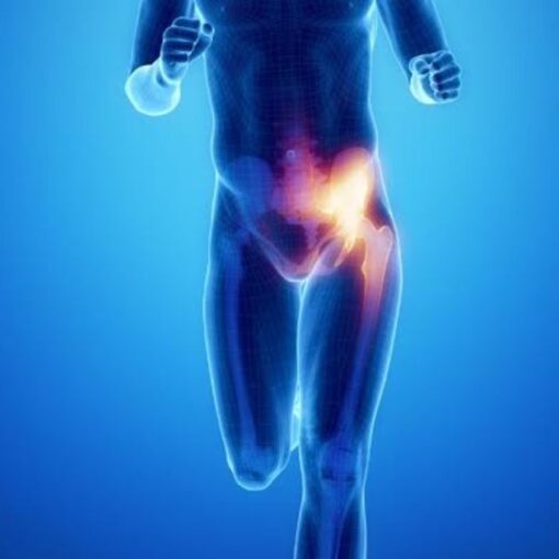 Βουβωνοκήλη στους αθλητες