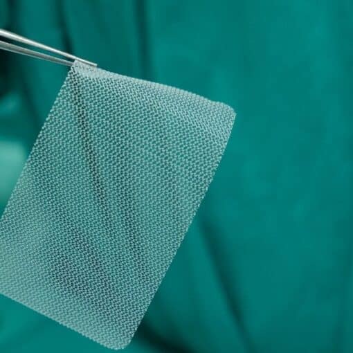 Πολυπροπυλένιο πλέγμα