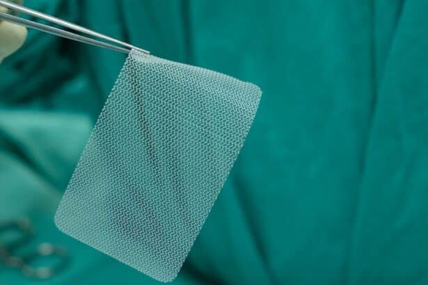 Πολυπροπυλένιο πλέγμα