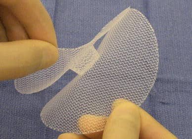 Διπλο πλέγμα