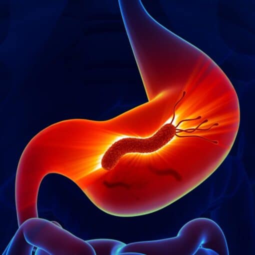 Helicobacter pylori