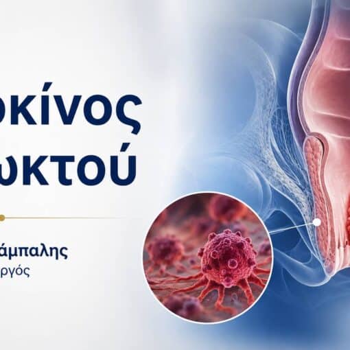 Greek medical poster about anal cancer: illustration of the anal canal with a tumor and a circular magnified inset showing cancer cells; text in Greek on the left.
