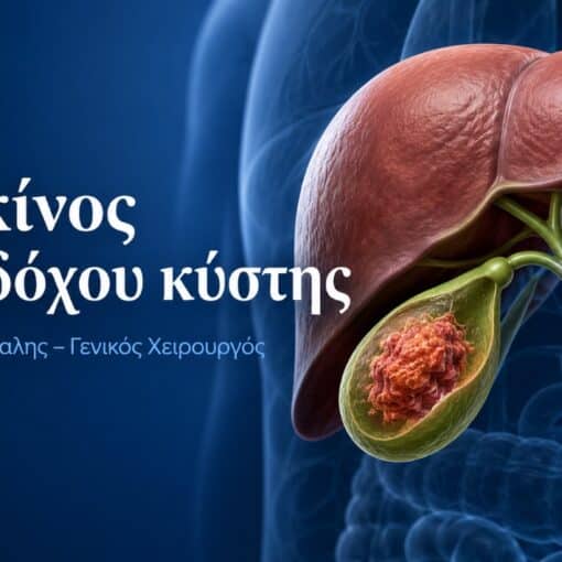 καρκίνος χοληδόχου κύστης