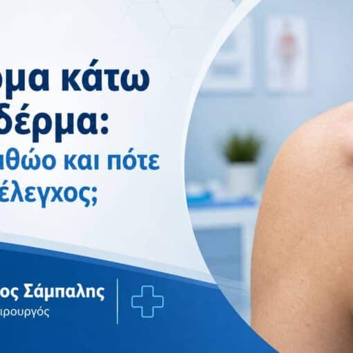 Εξόγκωμα κάτω από το δέρμα