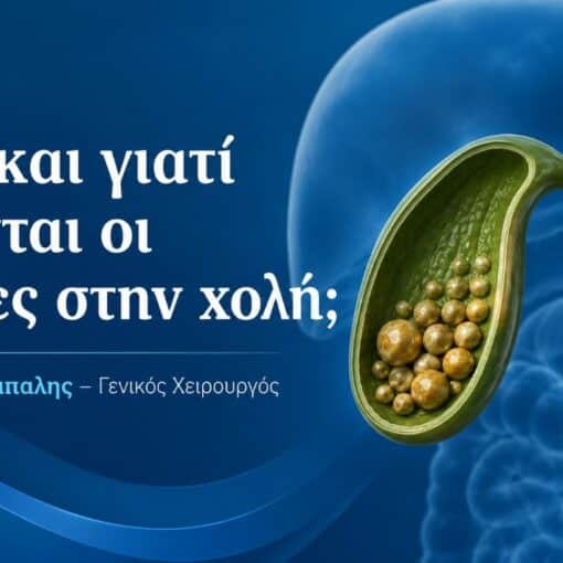Banner in Greek: 'Πώς και γιατί γίνονται οι πέτρες στην χολή;' by Γεώργιος Σάμπαλης – Γενικός Χειρουργός, with a gallbladder containing stones.