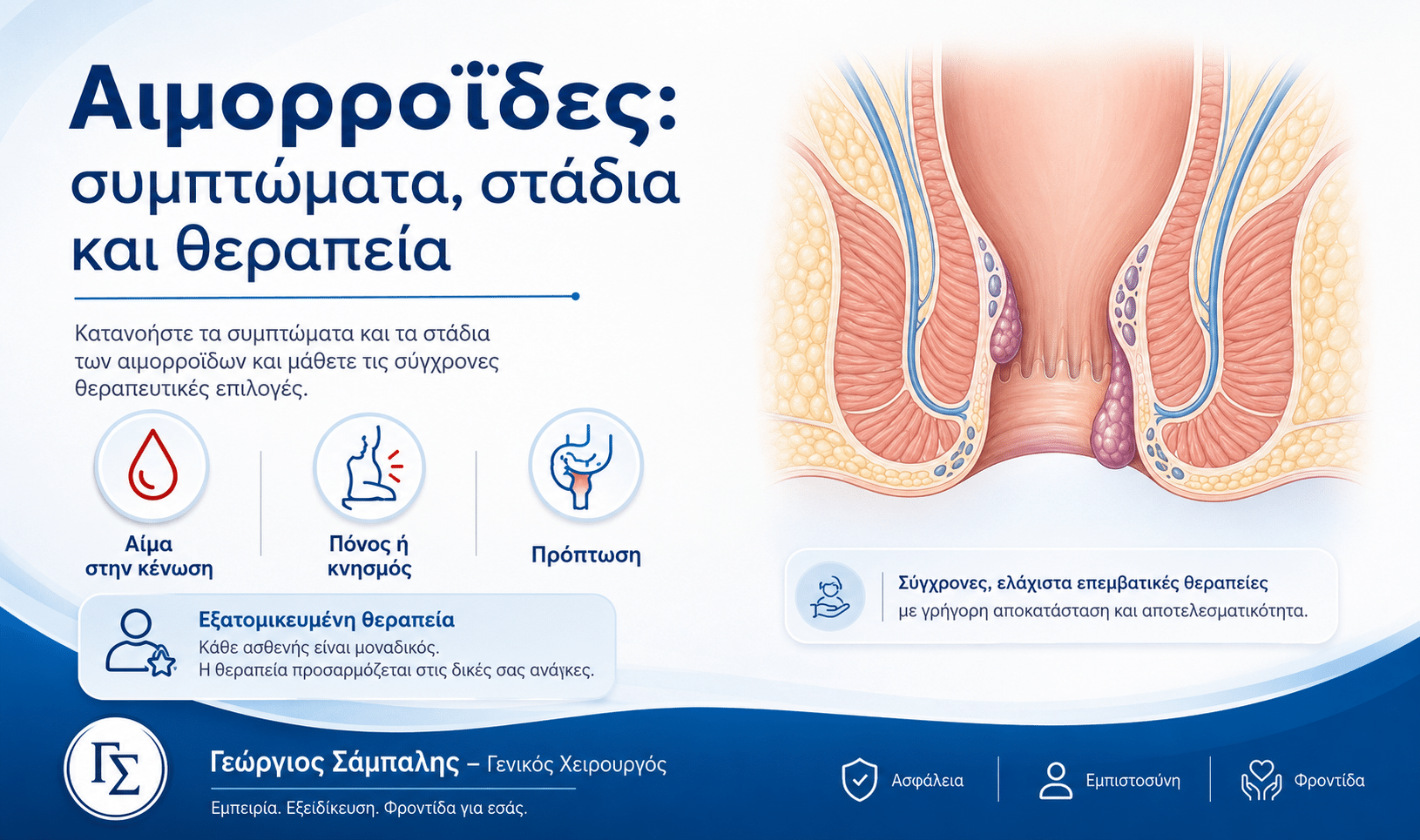Αιμορροΐδες συμπτώματα στάδια και θεραπεία με εξατομικευμένη ιατρική αξιολόγηση