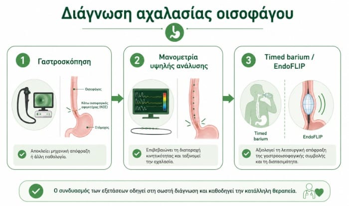 Διάγνωση αχαλασίας οισοφάγου με γαστροσκόπηση, μανομετρία υψηλής ανάλυσης και timed barium esophagram
