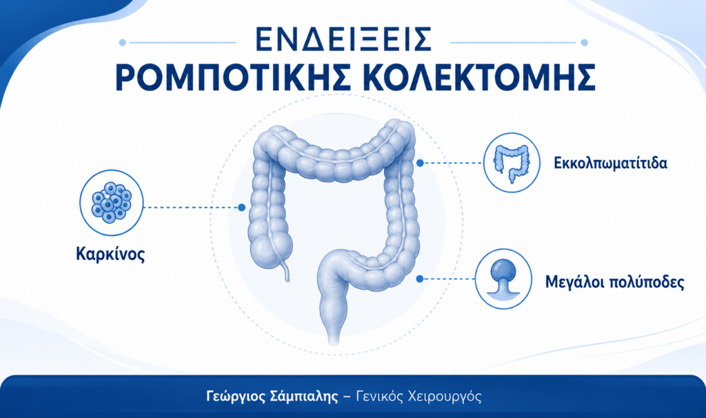 Ενδείξεις για ρομποτική κολεκτομή σε καρκίνο παχέος εντέρου, εκκολπωματίτιδα και μεγάλους πολύποδες