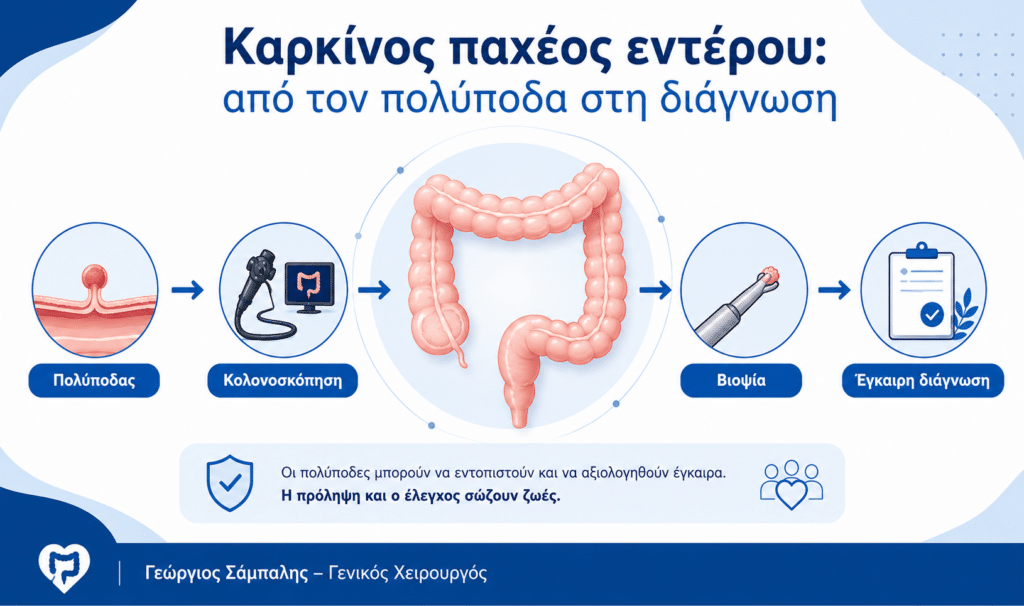 Καρκίνος παχέος εντέρου, πολύποδες, κολονοσκόπηση και έγκαιρη διάγνωση