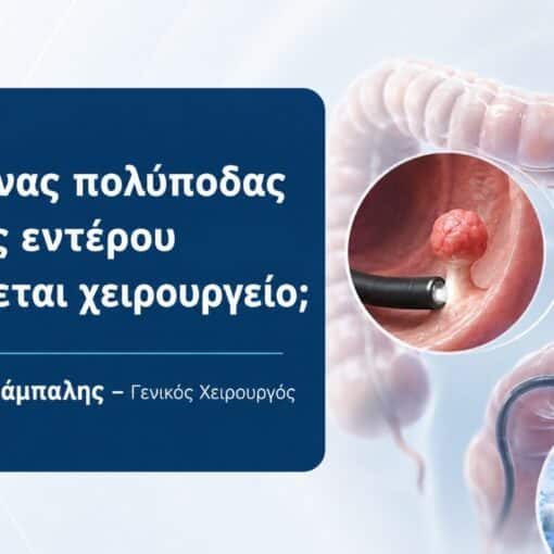 Greek banner asking when a colon polyp needs surgery; shows colon with a polyp and surgical tools in the background.
