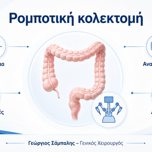 Ρομποτική κολεκτομή παχέος εντέρου με ρομποτικό σύστημα και ιατρική αξιολόγηση