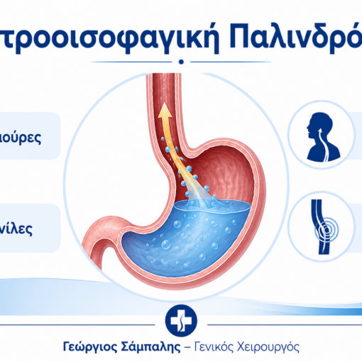 Γαστροοισοφαγική παλινδρόμηση με επιστροφή γαστρικού περιεχομένου προς τον οισοφάγο