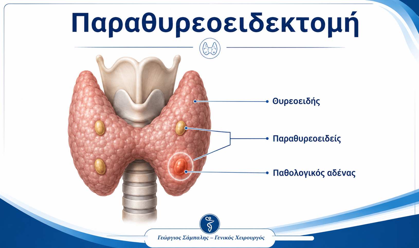 Παραθυρεοειδεκτομή και εντοπισμός παθολογικού παραθυρεοειδούς αδένα